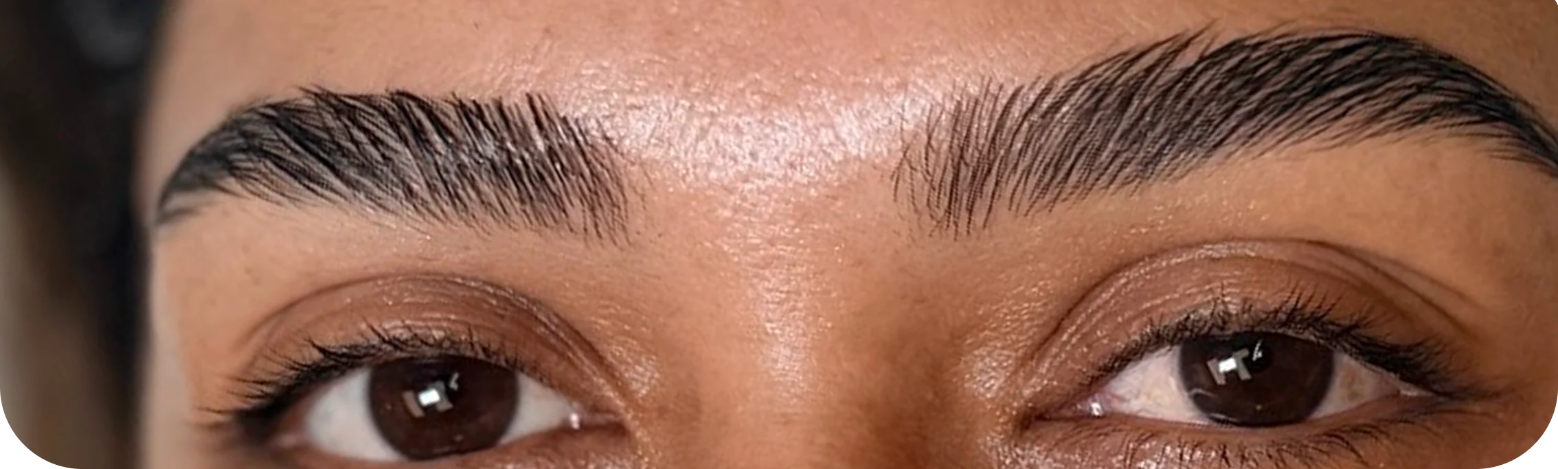 Brows, case 1: after the treatment.