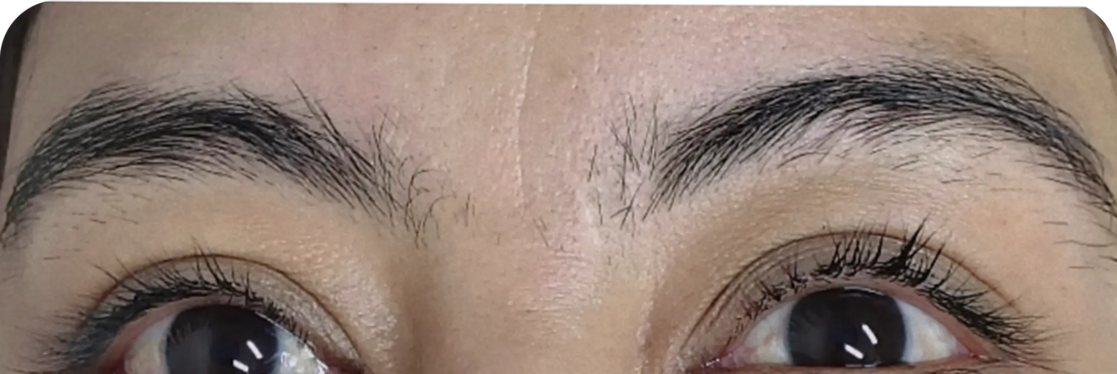 Brows, case 2: before the treatment.