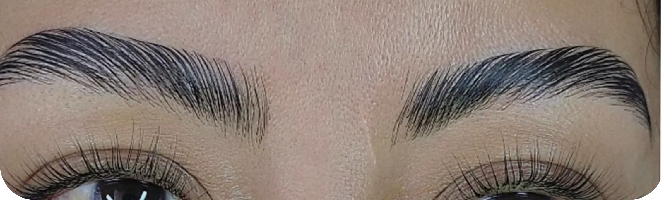 Brows, case 2: after the treatment.