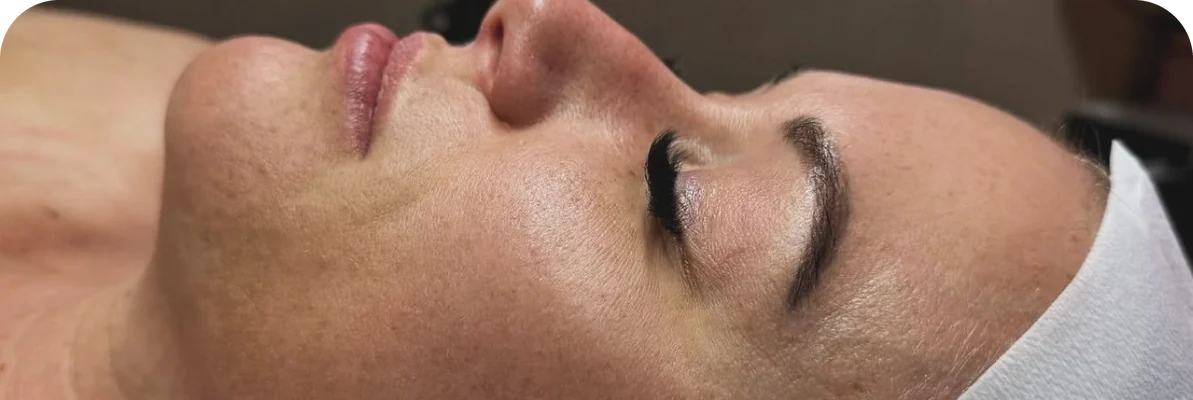 Facials, case 1: before the treatment.